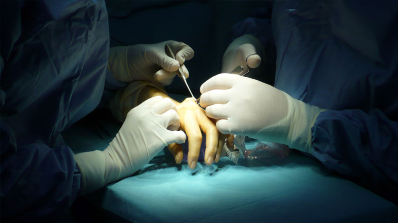 بهترین جراح ترمیم عصب دست